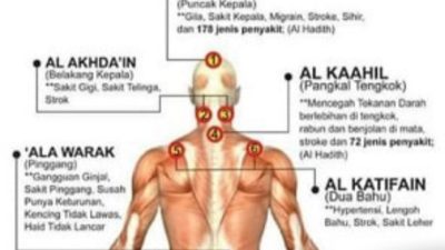 Menerima Bekam dan Ruqyah Ala Rasulullah